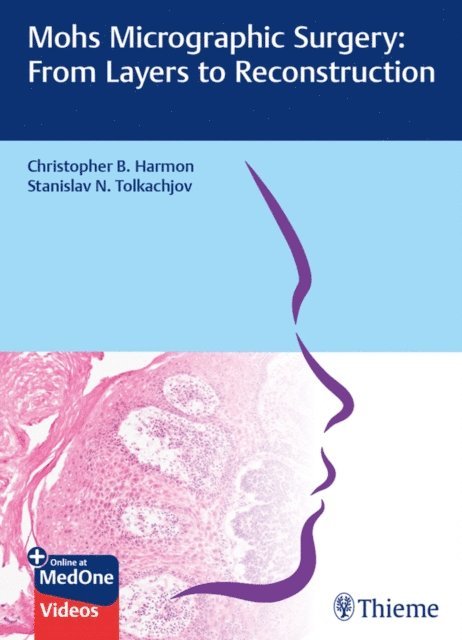 Stanislav N. Tolkachjov, Christopher B. Harmon - Mohs Micrographic Surgery: From Layers to Reconstruction, E-bok