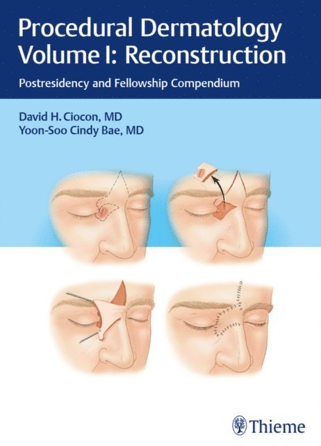 Yoon-Soo Cindy Bae, David H. Ciocon - Procedural Dermatology Volume I: Reconstruction, E-bok