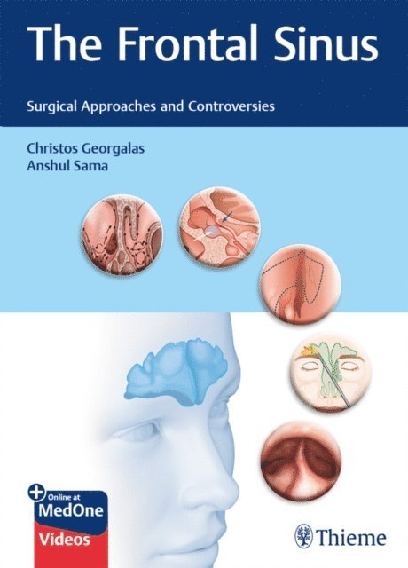 Anshul Sama, Christos Georgalas - Frontal Sinus, E-bok