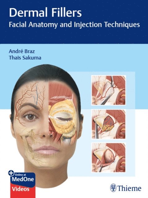 Thais Harumi Sakuma, Andre Vieira Braz - Dermal Fillers, E-bok