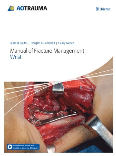 Fiesky A. Nunez, Doug A. Campbell, Jesse B. Jupiter - Manual of Fracture Management - Wrist, E-bok