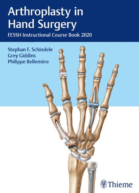 Philippe Bellemere, Grey Giddins, Stephan Schindele - Arthroplasty in Hand Surgery, E-bok
