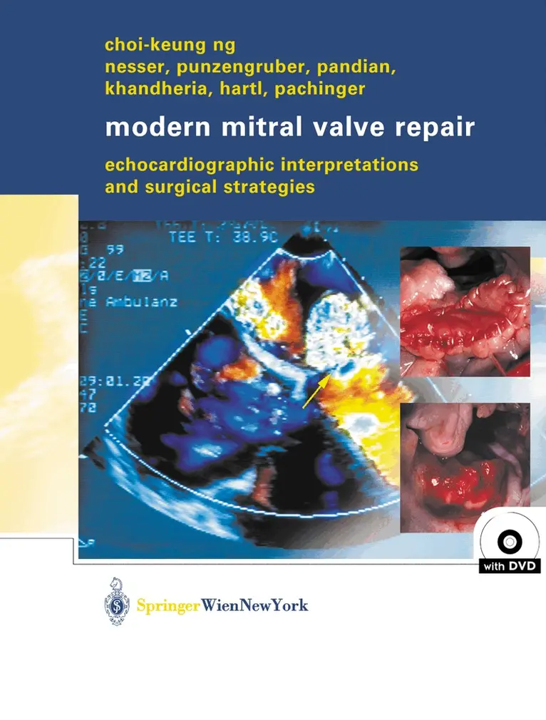 Choi-Keung Ng - Modern Mitral Valve Repair, Inbunden. Tillgänglighet: Lägg i varukorg
