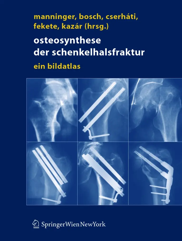 Jenö Manninger, Ulrich Bosch, Péter Cserháti, Karoly Fekete, György Kazar - Osteosynthese der Schenkelhalsfraktur, Inbunden. Tillgänglighet: Lägg i varukorg