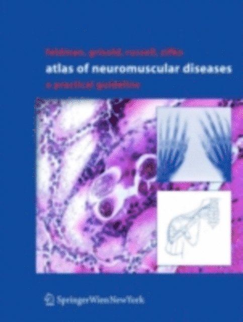 Udo A. Zifko, James W. Russell, Wolfgang Grisold, Eva L. Feldman - Atlas of Neuromuscular Diseases, E-bok