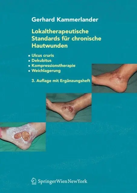 Gerhard Kammerlander - Lokaltherapeutische Standards für chronische Hautwunden, E-bok. Tillgänglighet: Lägg i varukorg