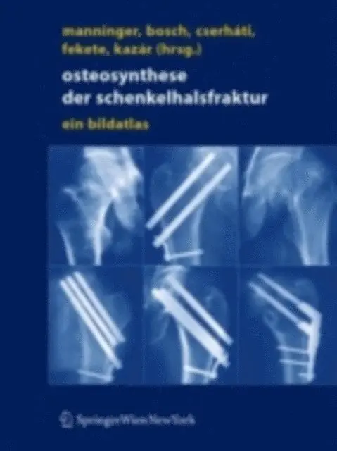 Gyorgy Kazar, Karoly Fekete, Peter Cserhati, Ulrich Bosch, Jeno Manninger - Osteosynthese der Schenkelhalsfraktur, E-bok. Tillgänglighet: Lägg i varukorg