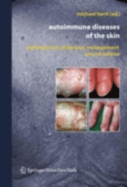 Michael Hertl - Autoimmune Diseases of the Skin, E-bok