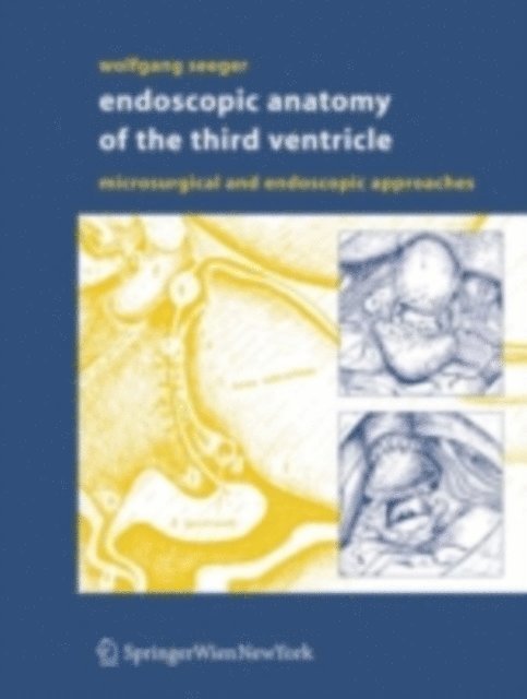 Wolfgang Seeger - Endoscopic Anatomy of the Third Ventricle, E-bok