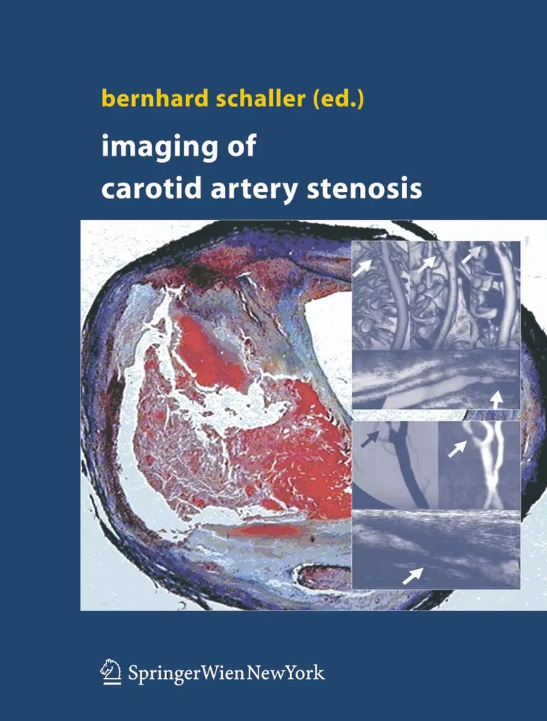 Bernhard Schaller - Imaging of Carotid Artery Stenosis, Inbunden. Tillgänglighet: Lägg i varukorg