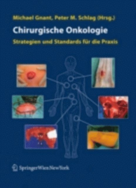 Peter M. Schlag, Michael Gnant - Chirurgische Onkologie, E-bok