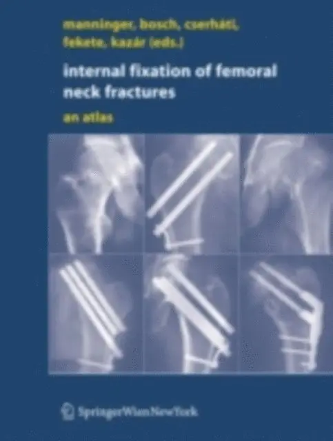 Gyorgy Kazar, Karoly Fekete, Peter Cserhati, Ulrich Bosch, Jeno Manninger - Internal fixation of femoral neck fractures, E-bok. Tillgänglighet: Lägg i varukorg
