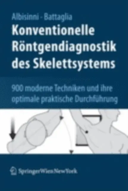 Milva Battaglia, Ugo Albisinni - Konventionelle Röntgendiagnostik des Skelettsystems, E-bok. Tillgänglighet: Lägg i varukorg