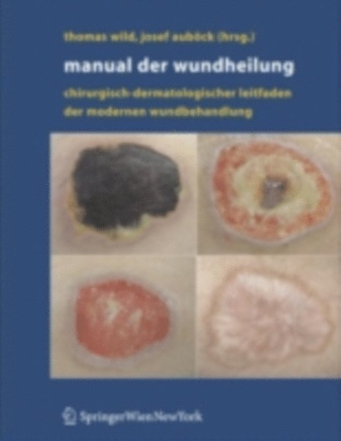 Josef Aubock, Thomas Wild - Manual der Wundheilung, E-bok