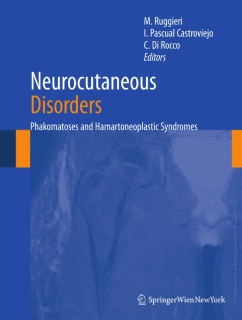 Concezio Di Rocco, Ignacio Pascual Castroviejo, Martino Ruggieri - Neurocutaneous Disorders, E-bok