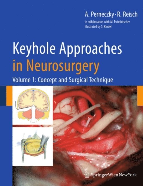 Robert Reisch, Axel Perneczky - Keyhole Approaches in Neurosurgery, E-bok
