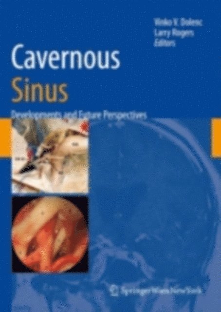Larry Rogers, Vinko V. Dolenc - Cavernous Sinus, E-bok. Tillgänglighet: Lägg i varukorg