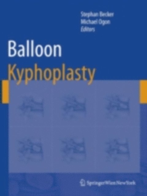 Michael Ogon, Stephan Becker - Balloon Kyphoplasty, E-bok