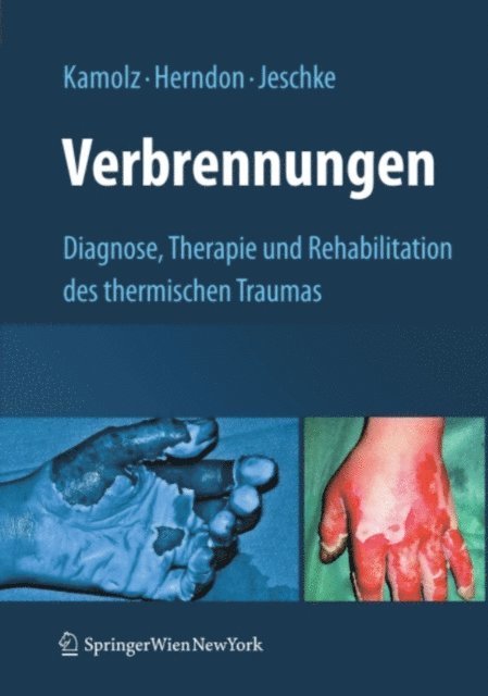 Marc G. Jeschke, David N. Herndon, Lars-Peter Kamolz - Verbrennungen, E-bok