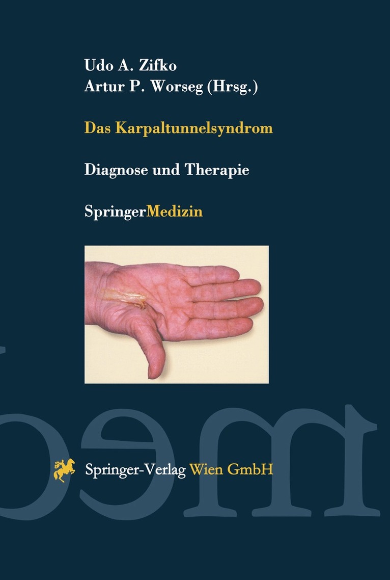 Udo A. Zifko, Artur P. Worseg - Das Karpaltunnelsyndrom, Häftad