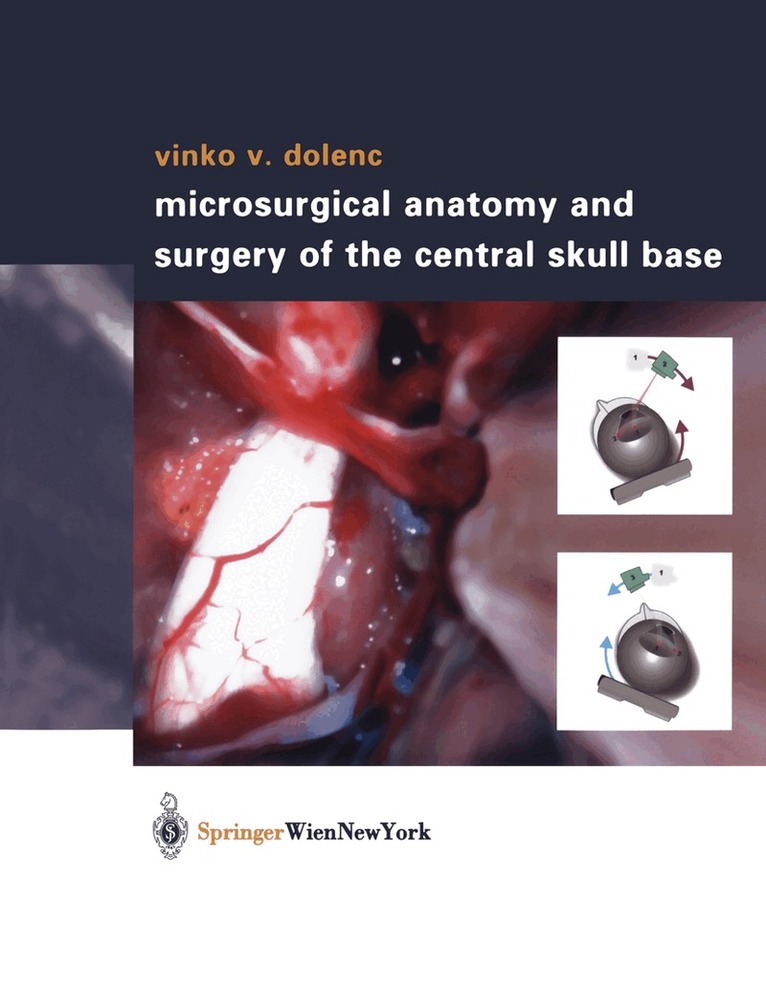 Vinko V. Dolenc - Microsurgical Anatomy and Surgery of the Central Skull Base, Inbunden