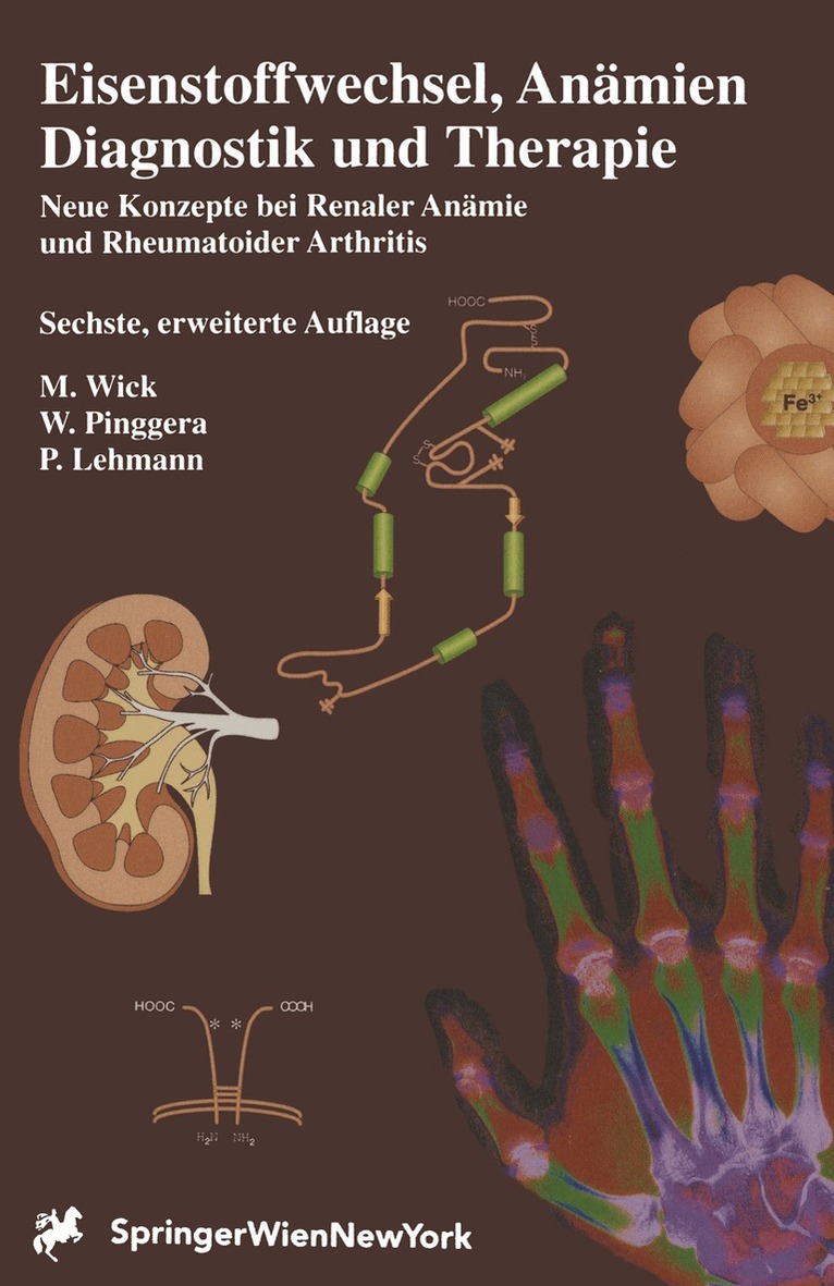 M. Wick, W. Pinggera, P. Lehmann - Eisenstoffwechsel, Anämien Therapie und Diagnose, Häftad