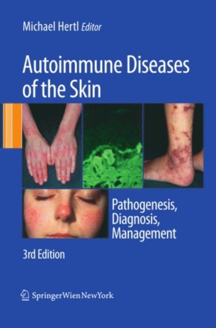 Michael Hertl - Autoimmune Diseases of the Skin, E-bok