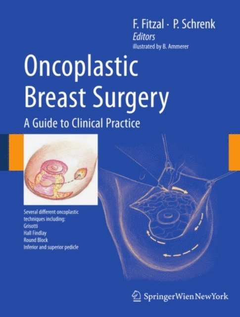 Peter Schrenk, Florian Fitzal - Oncoplastic Breast Surgery, E-bok