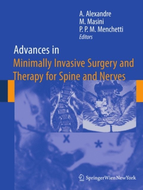 Pier Paolo Maria Menchetti, Marcos Masini, Alberto Alexandre - Advances in Minimally Invasive Surgery and Therapy for Spine and Nerves, E-bok