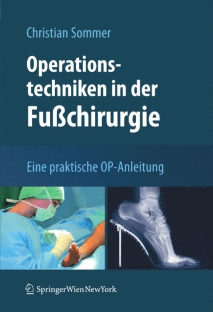 Christian Sommer - Operationstechniken in der Fußchirurgie, E-bok