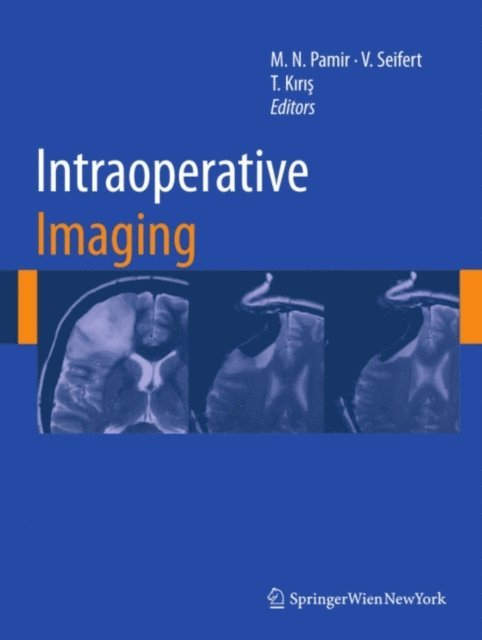 Talat Kiris, Volker Seifert, M. Necmettin Pamir - Intraoperative Imaging, E-bok