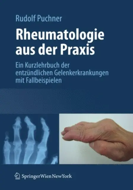 Rudolf Puchner - Rheumatologie aus der Praxis, E-bok. Tillgänglighet: Lägg i varukorg