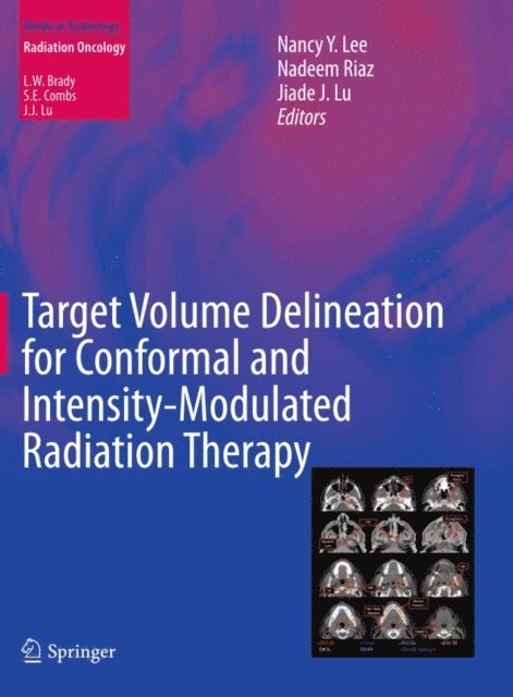 Jiade J. Lu, Nadeem Riaz, Nancy Y. Lee - Target Volume Delineation for Conformal and Intensity-Modulated Radiation Therapy, E-bok