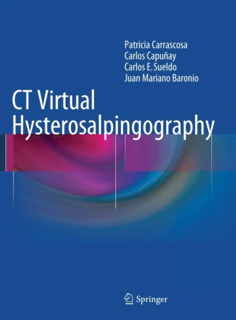 Juan Mariano Baronio, Carlos E. Sueldo, Carlos Capunay, Patricia Carrascosa - CT Virtual Hysterosalpingography, E-bok