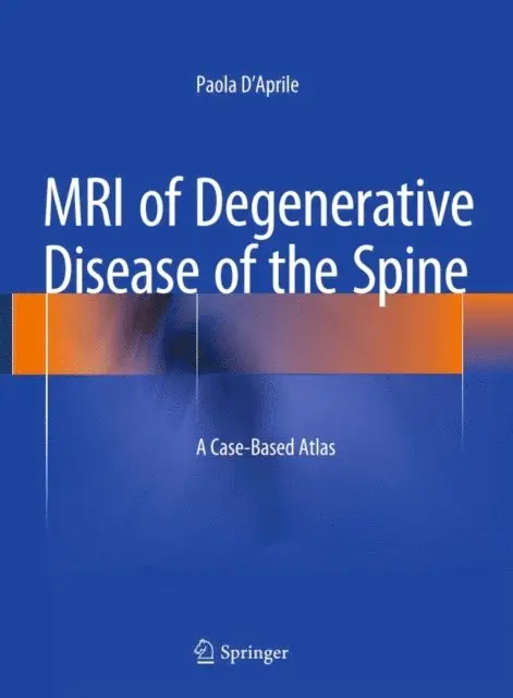 Paola D'Aprile - MRI of Degenerative Disease of the Spine, E-bok. Tillgänglighet: Lägg i varukorg