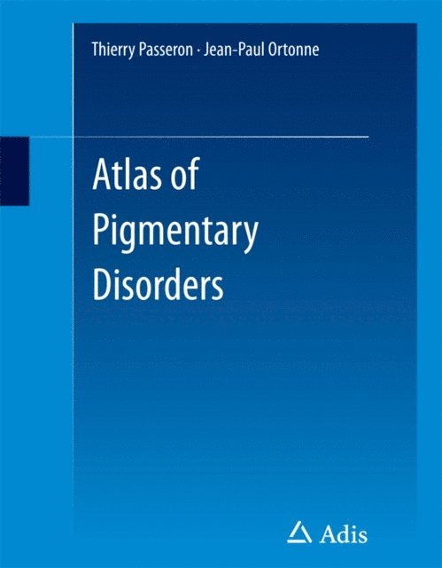 Jean-Paul Ortonne, Thierry Passeron - Atlas of Pigmentary Disorders, E-bok