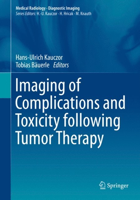 Tobias Bauerle, Hans-Ulrich Kauczor - Imaging of Complications and Toxicity following Tumor Therapy, E-bok