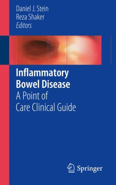Reza Shaker, Daniel J. Stein - Inflammatory Bowel Disease, E-bok