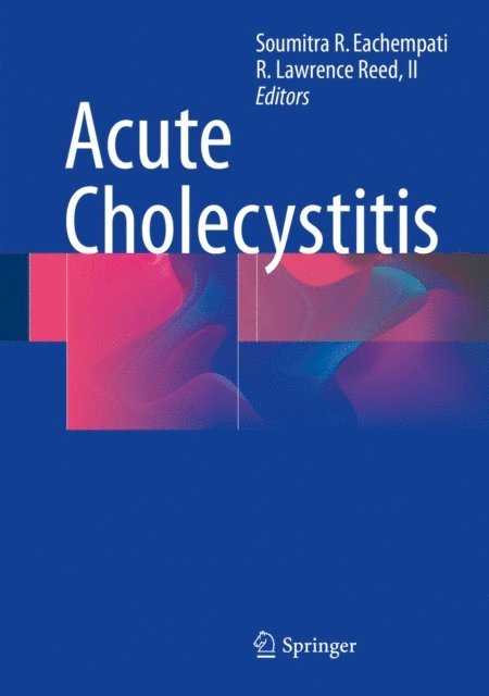 R. Lawrence Reed, II, Soumitra R. Eachempati - Acute Cholecystitis, E-bok. Tillgänglighet: Lägg i varukorg