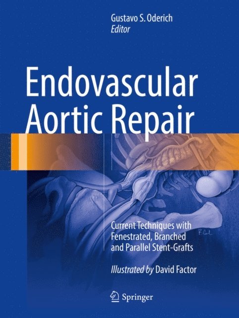 Gustavo S. Oderich - Endovascular Aortic Repair, E-bok. Tillgänglighet: Lägg i varukorg