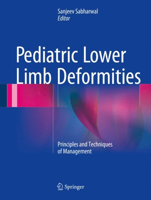 Sanjeev Sabharwal - Pediatric Lower Limb Deformities, E-bok
