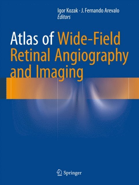 J. Fernando Arevalo, Igor Kozak - Atlas of Wide-Field Retinal Angiography and Imaging, E-bok