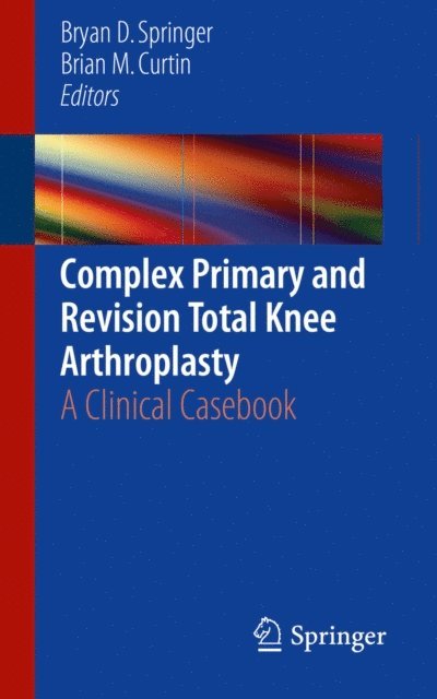 Brian M. Curtin, Bryan D. Springer - Complex Primary and Revision Total Knee Arthroplasty, E-bok. Tillgänglighet: Lägg i varukorg
