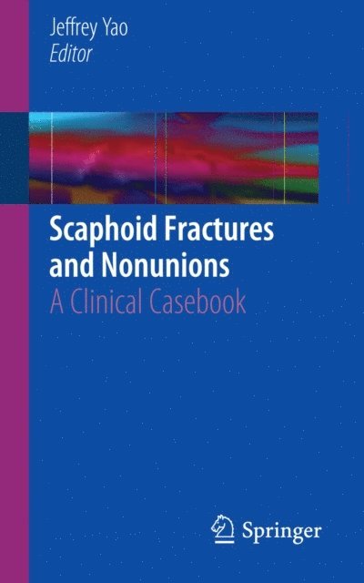 Jeffrey Yao - Scaphoid Fractures and Nonunions, E-bok