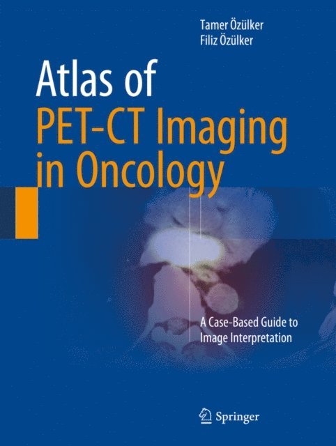 Filiz Ozulker, Tamer Ozulker - Atlas of PET-CT Imaging in Oncology, E-bok