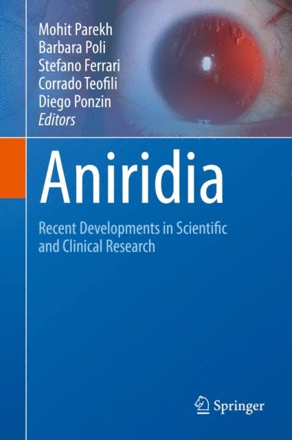 Diego Ponzin, Corrado Teofili, Stefano Ferrari, Barbara Poli, Mohit Parekh - Aniridia, E-bok