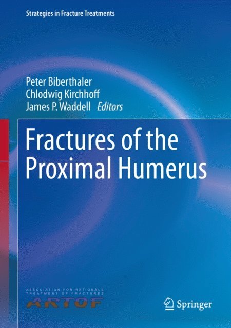 James P. Waddell, Chlodwig Kirchhoff, Peter Biberthaler - Fractures of the Proximal Humerus, E-bok