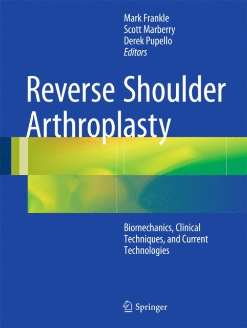 Derek Pupello, Scott Marberry, Mark Frankle - Reverse Shoulder Arthroplasty, E-bok