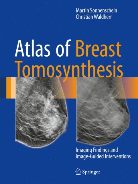 Christian Waldherr, Martin Sonnenschein - Atlas of Breast Tomosynthesis, E-bok