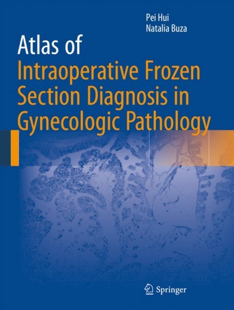 Natalia Buza, Pei Hui - Atlas of Intraoperative Frozen Section Diagnosis in Gynecologic Pathology, E-bok